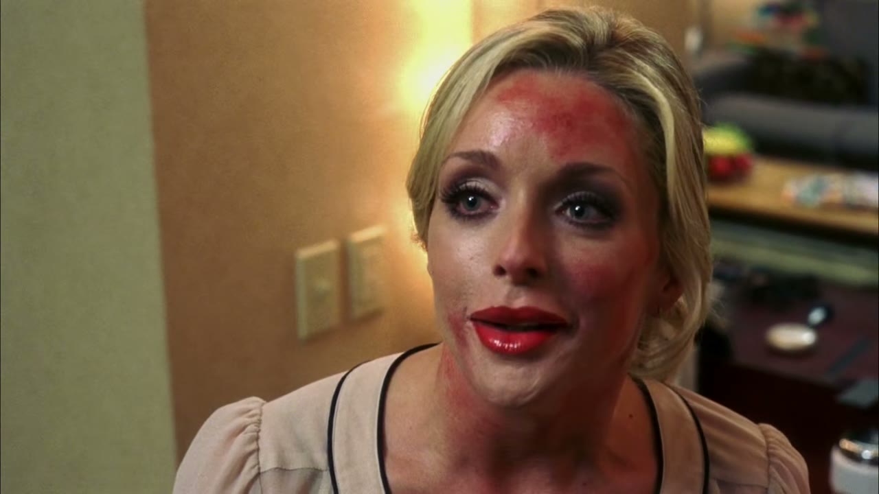 Okay, I had a little Botox and some collagen,