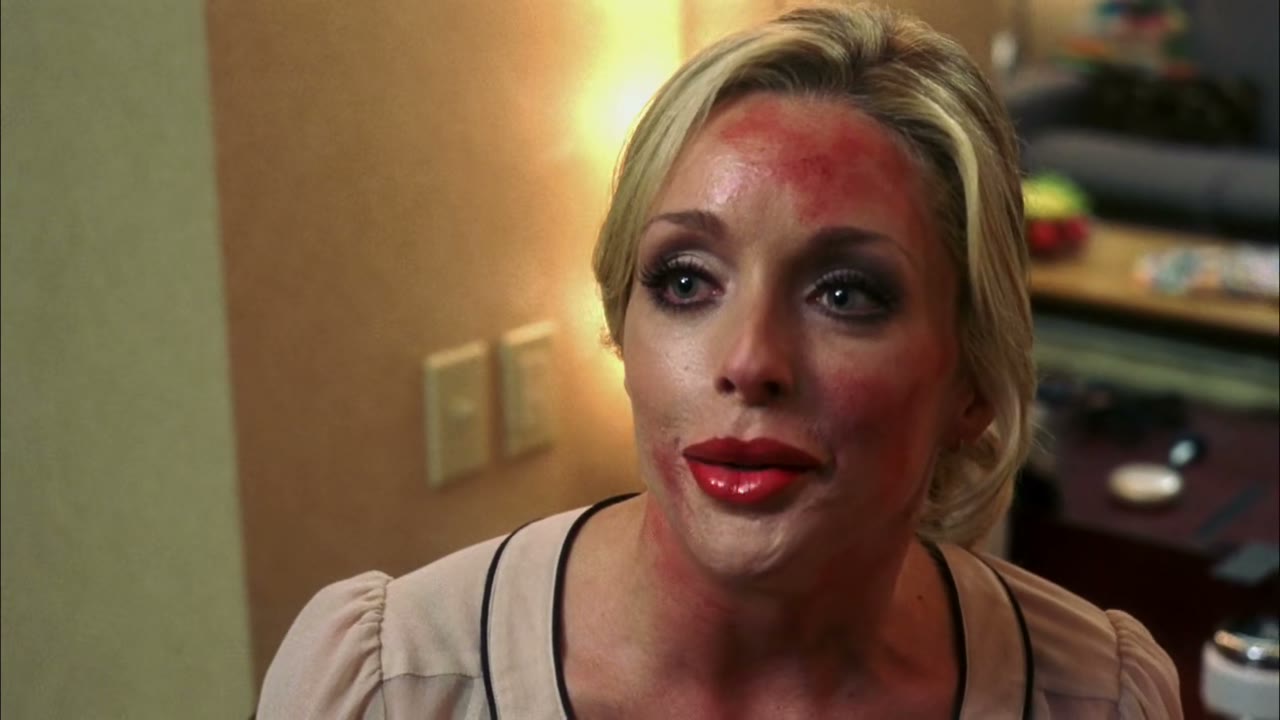 Okay, I had a little Botox and some collagen,