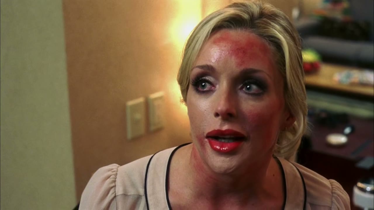 And a chemical peel,