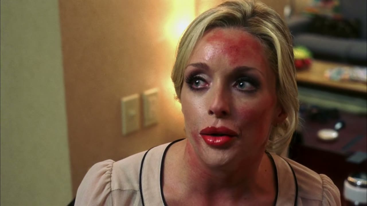 And a chemical peel,